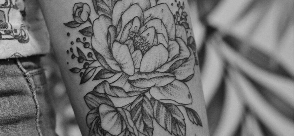 Eliminación de tatuajes